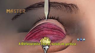 Ilson Rosique-11