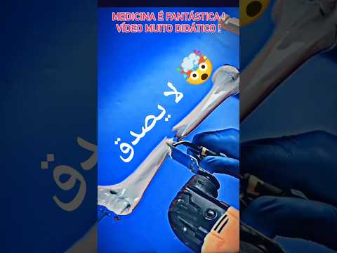 الطب ومعالجة العظام 