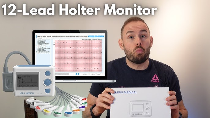 A Comparison of Holter Monitor and Wellue 24-Hour ECG Recorder with AI