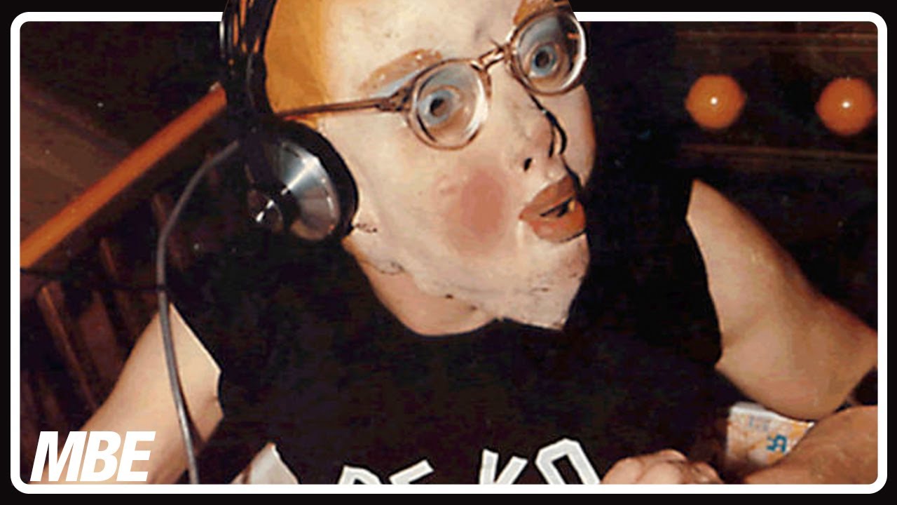 Who is BOOJI BOY? │ DEVO's Weird Mascot 