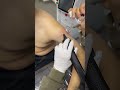 Scar free tattoo removal ep288 short