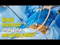 Uşaqlıq borularında əməliyyatlar necə yerinə yetirilir? ( Cərrah mama ginekoloq Aytən Nəcəfəliyeva )