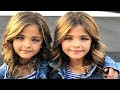 5 MOST UNUSUAL AND BEAUTIFUL KIDS IN THE WORLD