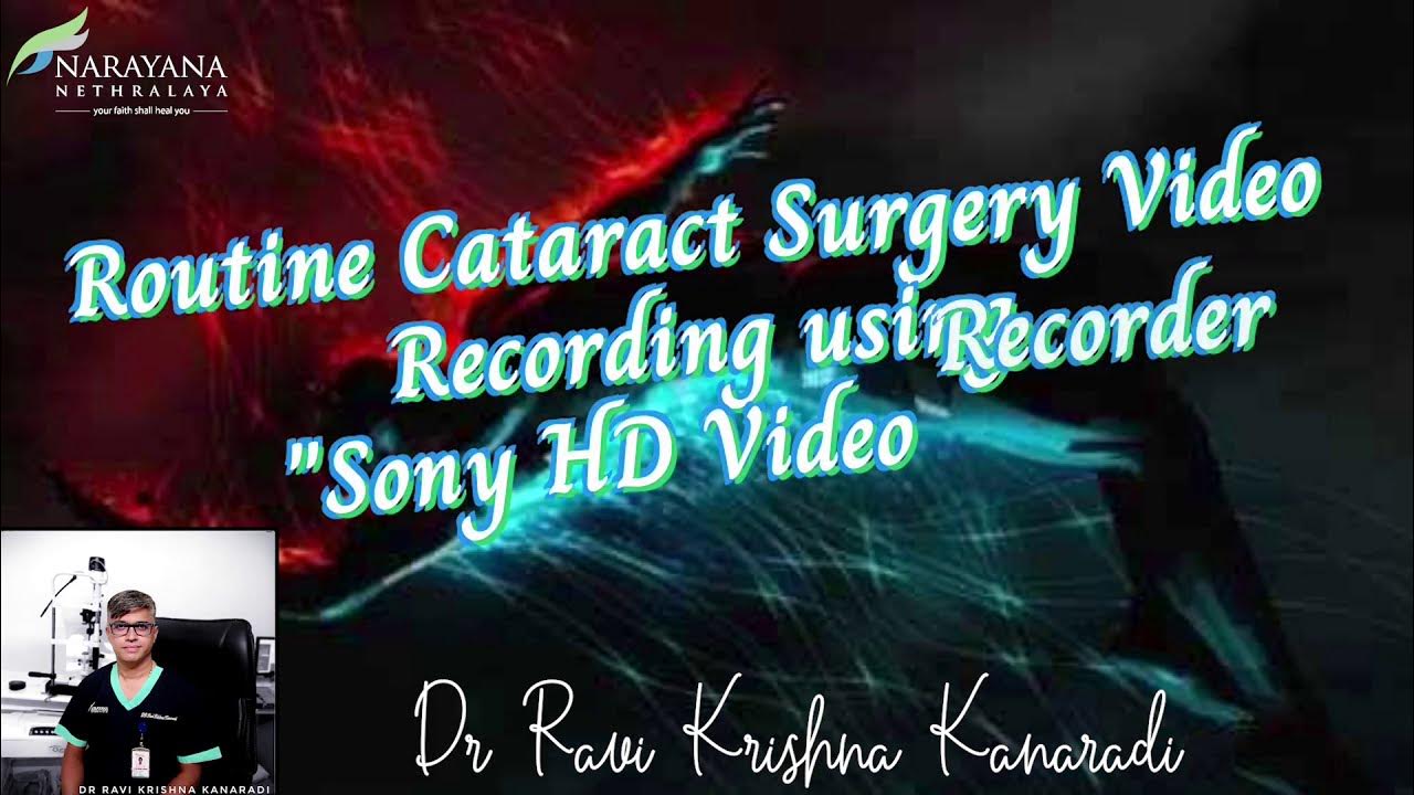 Phacoemulsification with Foldable IOL Surgery Video recording Using