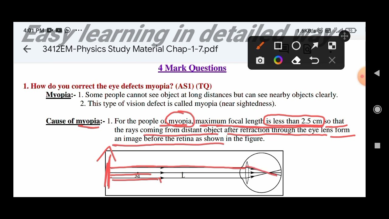 How Do You Correct The Eye Defect Myopia