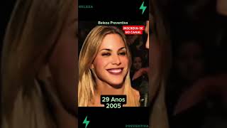 Evolução Joana Prado Feiticeira - Beleza Preventiva