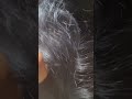 #fypviralシ #statisfying #lice #hair #LiceOnHead #liceremoval #brasil #xyzbcafyp #licecomb #kutu