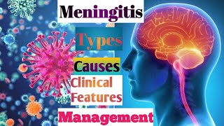 MENINGITIS Defination,Types,sign and symptoms ,DIAGNOSIS , MANAGEMENT,Meningitis bhaneko ke ho?