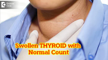 Swollen thyroid but blood test normal. What does it mean? - Dr. Harihara Murthy | Doctors' Circle