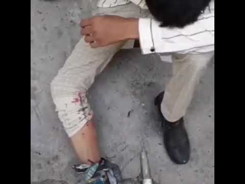 در جریان اعتراضات #لردگان ، یک دانش‌آموز هدف گلوله‌ نیروهای سرکوبگر قرار گرفت