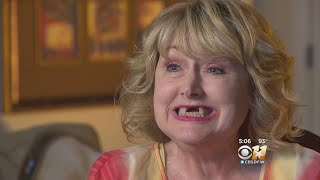 Woman Wakes Up From Minor Surgery With Front Teeth Missing
