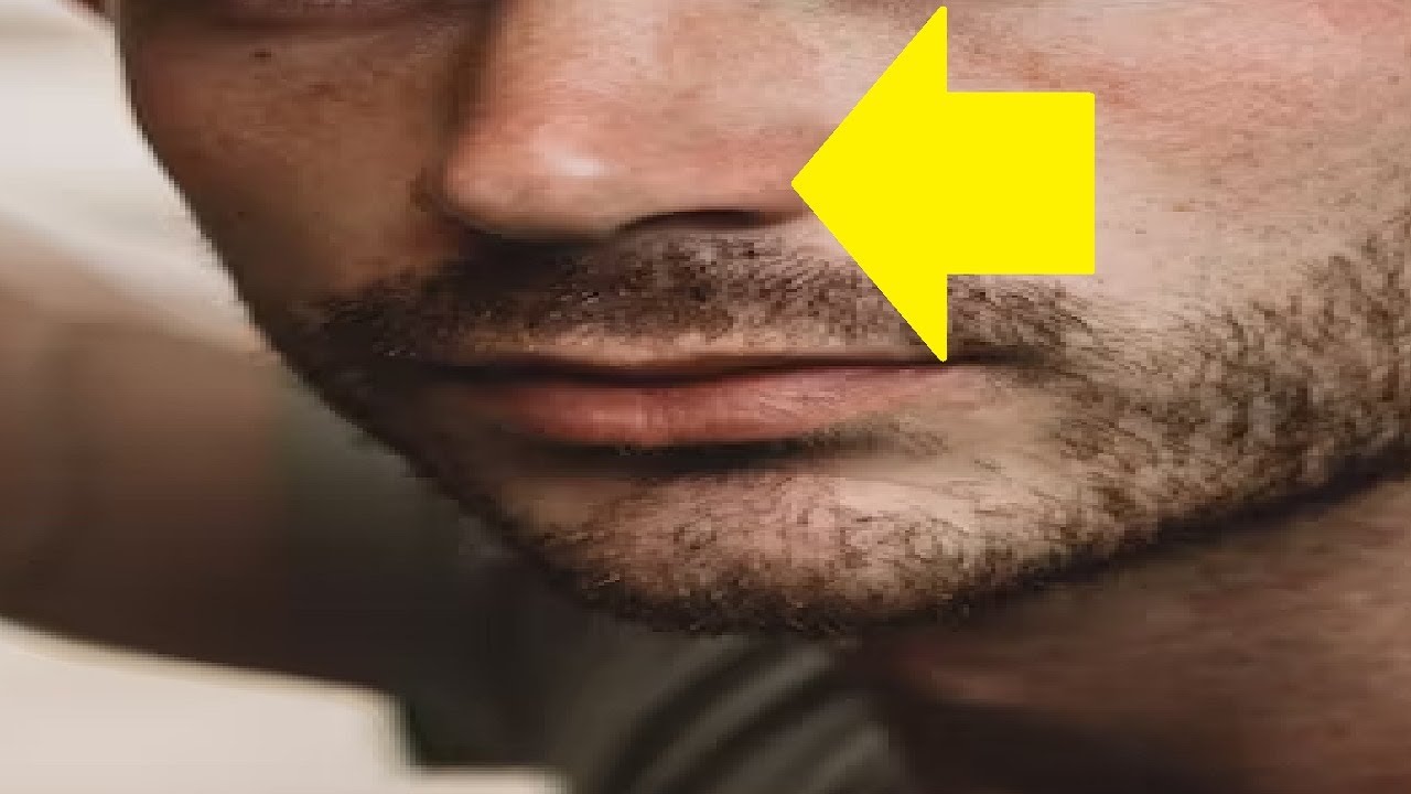 How To Get Rid Of Nose Pimples Inside Your Nose YouTube how-to-get-rid-of-nose-pimples-inside-your-nose-youtube