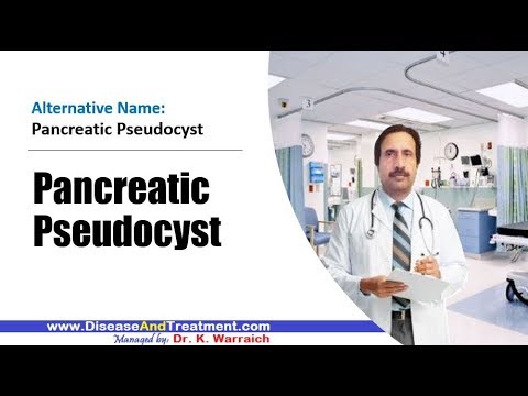 Pancreatic Pseudocyst :