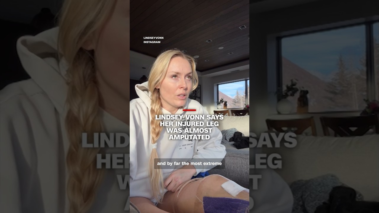 Lindsey Vonn says doctor saved her leg from being amputated