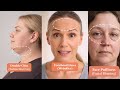 Ultimate Face Yoga Routine for Double Chin, Puffy Face & Wrinkles | Natural Face Lift at Home