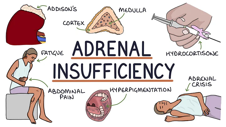 Understanding Adrenal Insufficiency