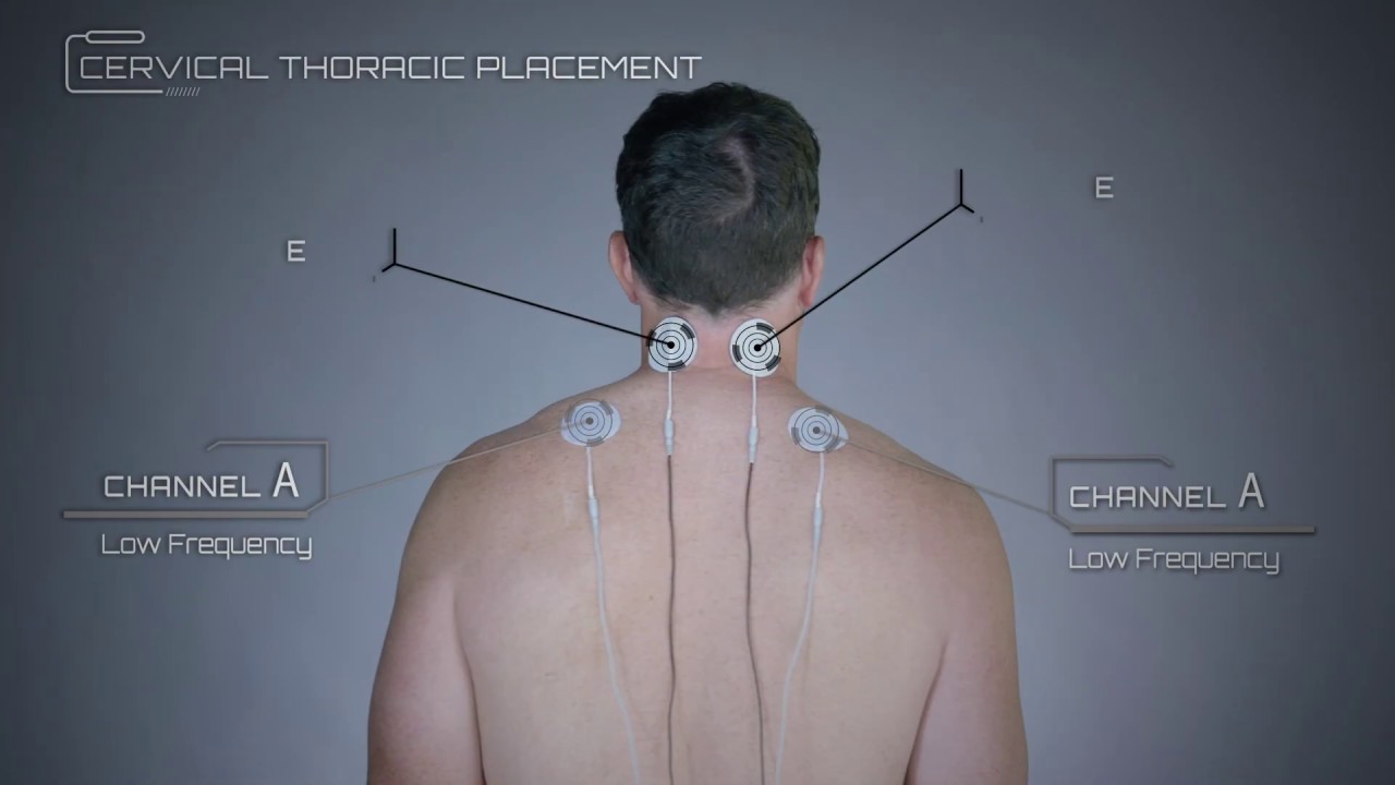 Cervical Thoracic Placement Example 