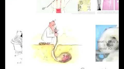 Warm vertical compaction, apical scouting apical gauging 19-01- 2019