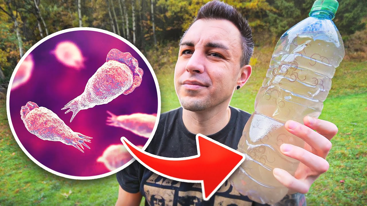 CE PARASITE MANGE TON CERVEAU ! (Tu n'es pas prêt)