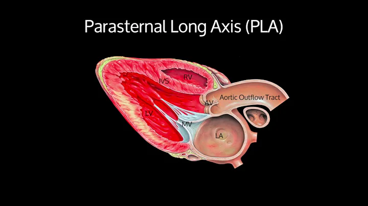 Basic Transthoracic Echocardiography (Cardiac Ultrasound) - TTE Made Simple