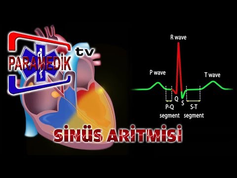 Video: Sinus ritmi aritmiya yaradırmı?