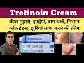 Benefits of tretinoin cream 0025  tretinoin cream review