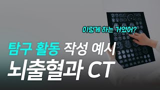 탐구활동 작성 예시 : 뇌출혈과 CT