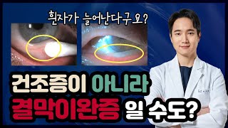 [눈 건강] 충혈, 이물감, 눈물, 건조증이 아니라 결막이완증 일 수도?