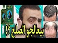زيت دابر املا و زيت تريشوب لعلاج تساقط الشعر موجود في مصر و السعودية و الجزائر و المغرب