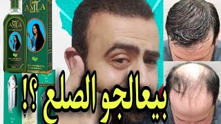 زيت دابر املا و زيت تريشوب لعلاج تساقط الشعر | موجود في مصر و السعودية و الجزائر و المغرب