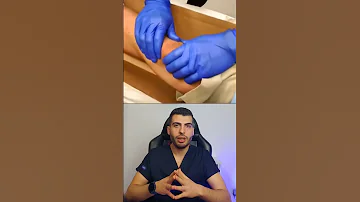 خلع مفصل الركبة خلع خلع مفصل العظمية مفاصل الركبة الرباط الصليبي د مصعب حسوا ثقف نفسك طبيا 