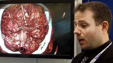 RSNA 2010: 3D Radiology Tech from Object Research Systems (ORS)