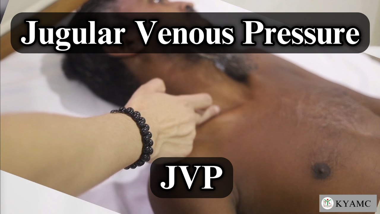 Jvp Less Jugular Venous Pressure (JVP) | Standardized Clinical Examination ...