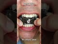 Satisfying Chewing ASMR #Compilation #ASMR #DoctorTristanPeh