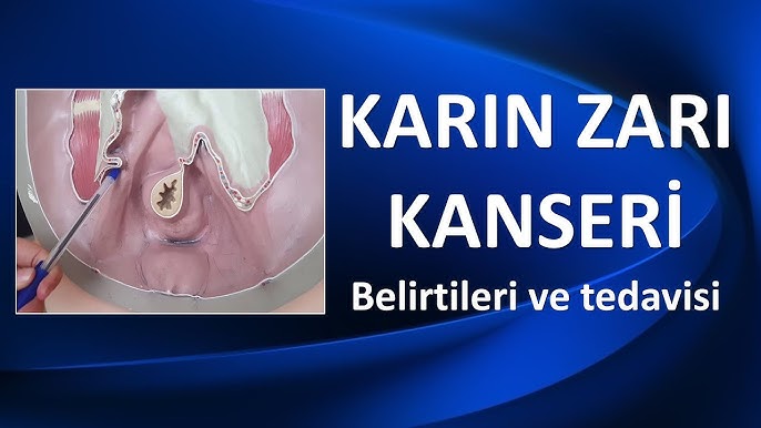 periton hastaligi icin oneriler diyanet tv youtube