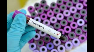 Another significant increase sends Ghana’s Covid-19 cases to 636