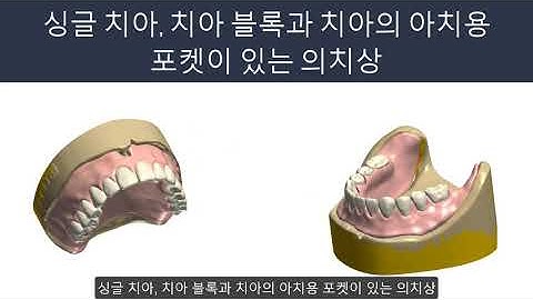 3Shape 덴탈시스템 - 가공치와 의치상을 이용한 의치 Dental System - Base with designed teeth