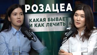 Розацеа:  какая бывает и как лечить? #розацеа #красноелицо #сосудылицо #пятнаналице #проблемнаякожа