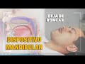 Cómo funciona el Dispositivo de Avance Mandibular?