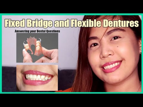 Flexible and Fixed Bridge Dentures - Answering your Questions and Updates | Jean&rsquo;s VLogs
