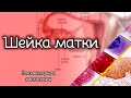 Шейка матки | Элементарная гистология