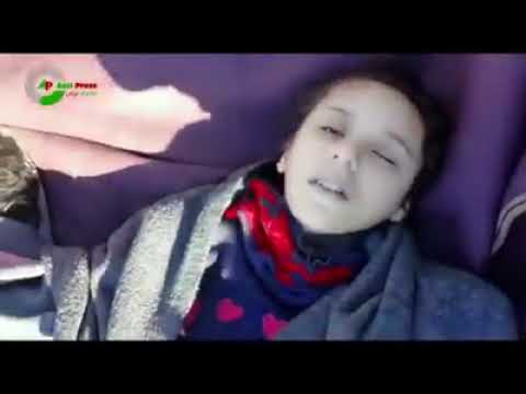 Video: Çocuk Gözleri Açık Uyur: Norm Veya Sapma