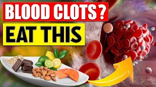 10 Incredible Foods That Dissolve Blood Clots Like No Other 🍊🍫