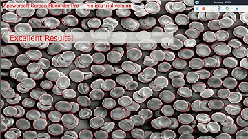 ECE6258 Fall2017: Red Blood Cell Segmentation using Ant Colony Optimization