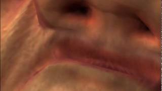 Iphone ear rape