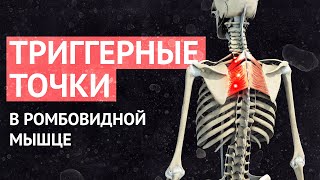 Поиск и коррекция триггерных точек в ромбовидной мышце