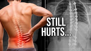 Why Spine Surgery Might Fail
