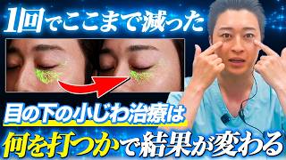 【実は間違ってるかも?】目の下の小じわに最適な施術を解説します。