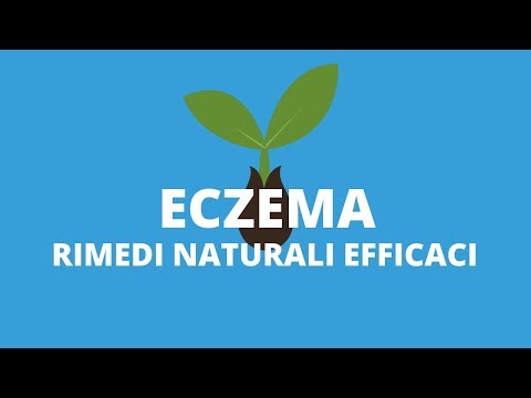 Video: Trattamento Dell'eczema Con Rimedi Popolari - 7 Rimedi Efficaci