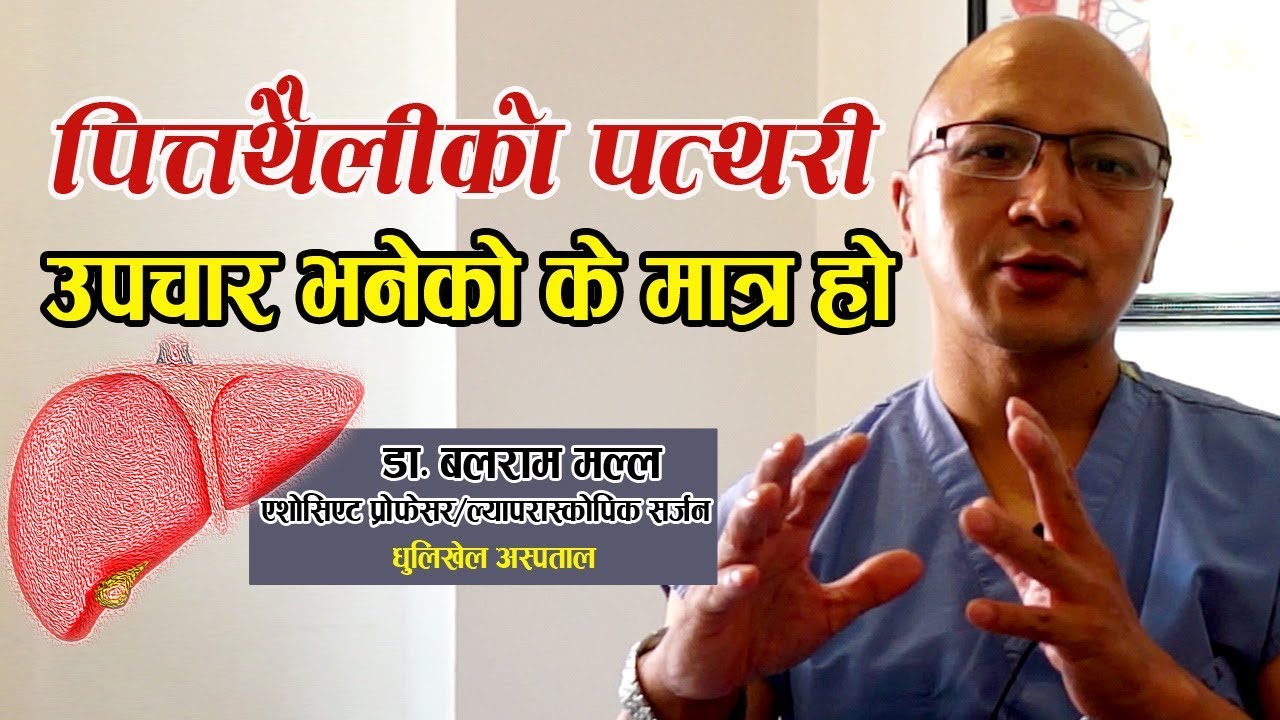 पित्तथैलीको पत्थरी उपचार II Gallbladder stones by Dr Balaram Malla